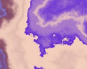 der kontaktlinsen