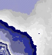 kontaktlinse