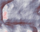 kontaktlinsen biomedics