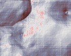 augen kontaktlinsen