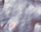 kontaktlinsen trockene